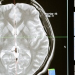 Elastyczny mózg: jak działa neuroplastyczność i jak ją wzmacniać na co dzień